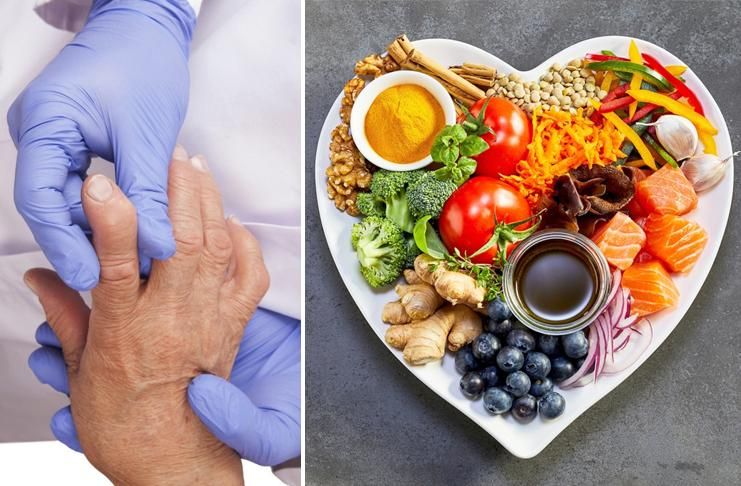 Как правильно питаться при подагре: простые советы для здоровья суставов