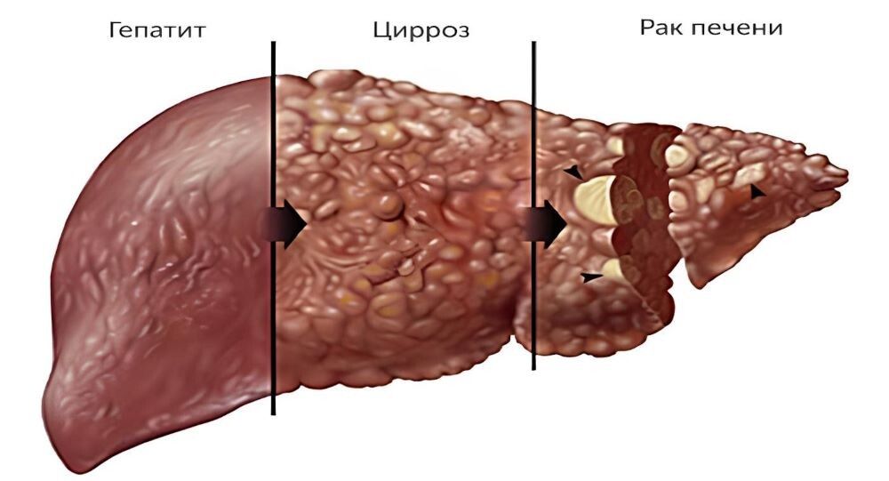 ������� � ������ ������: ��� ����� �����